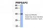 PRPSAP2 Antibody - N-terminal region